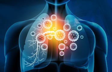 Astma vermindert door voedingsplan op maat