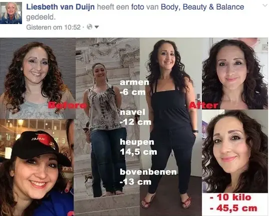 Semia-Ekici-en-lipoedeem