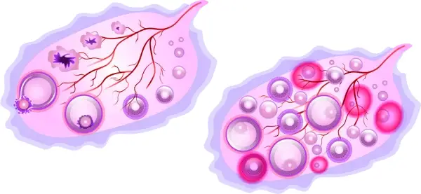 thyroid (1)-1